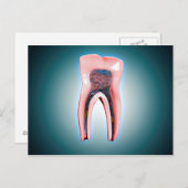 Querschnitt eines menschlichen Zahnes Postkarte (Vorne/Hinten)