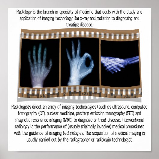 RADIOLOGIE - XRAY POSTER - HAND, OK, HANDSHAKE (Vorne)