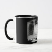 RADIOLOGISTISCHER FOTO-BOMB-T - Shirt Tasse (Links)