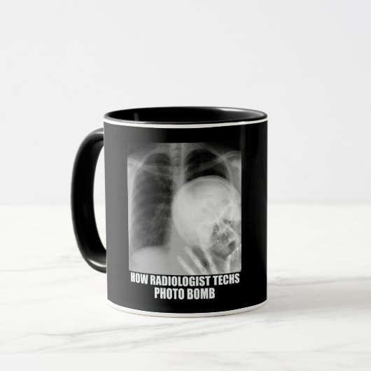 RADIOLOGISTISCHER FOTO-BOMB-T - Shirt Tasse (Vorderseite Links)