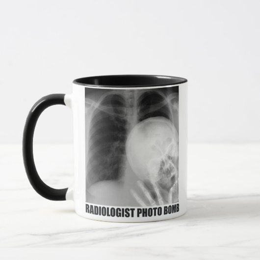 RADIOLOGISTISCHES FOTO BOMB TASSE (Links)