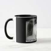 RADIOLOGISTISCHES FOTO BOMB TASSE (Links)