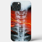 Ray Digital Artwork Phone Case (Rückseite)