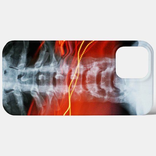 Ray Digital Artwork Phone Case (Rückseite (Horizontal))