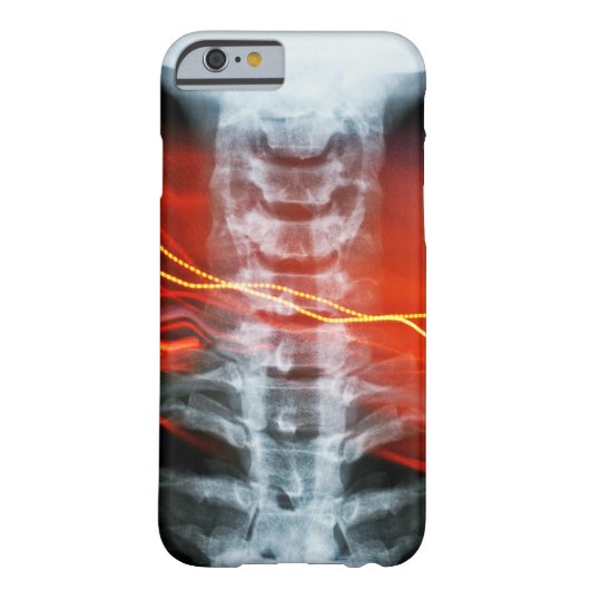 Ray Digital Artwork Phone Case (Rückseite)