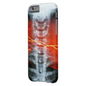 Ray Digital Artwork Phone Case (Rückseite Links)
