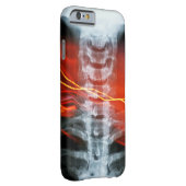 Ray Digital Artwork Phone Case (Rückseite/Rechts)