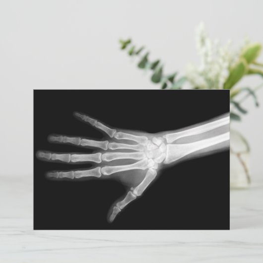 Ray Skeleton Arms Black & White Einladung (Stehend Vorderseite)