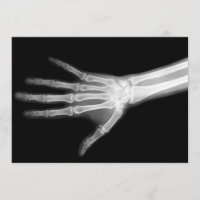 Ray Skeleton Arms Black & White