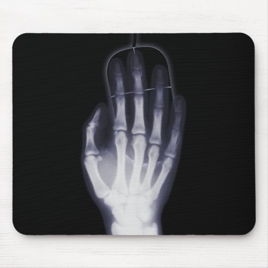 Ray Skeleton Hand Xray Mousepad (Vorne)