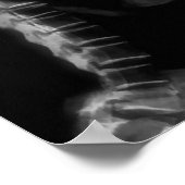 RAY VISION SKELETON SINGING ON RETRO MIC - B&W POSTER (Ecke)