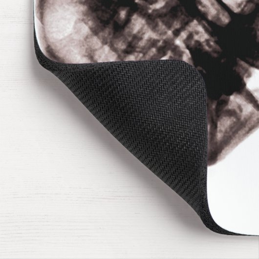 Ray Vision Skeleton Skull Face Mousepad (Ecke)