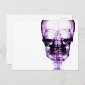 Ray Vision Skeleton Skull - Lila Postkarte (Vorne/Hinten)