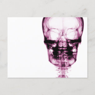 Ray Vision Skeleton Skull - Rosa Postkarte