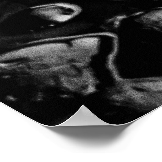 Regen in Rom-Poster Poster (Ecke)