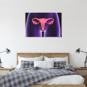 Reproduktionsorgan bei Frauen, Röntgenbild 1 Leinwanddruck (Insitu (Schlafzimmer))