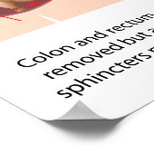 Restorative Proktoktomie mit j-pouch 2 Bühnen Poster (Ecke)