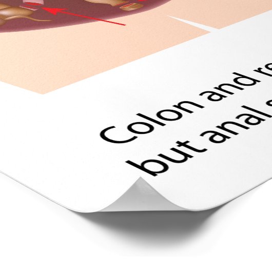Restorative Proktoktomie-Operation mit j-pouch Poster (Ecke)