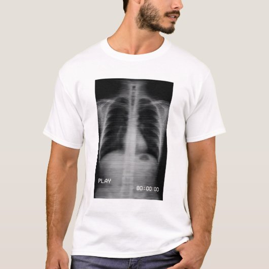 “Retro VHS X-Ray” Old-school chest X-ray with VHS T-Shirt (Vorderseite)