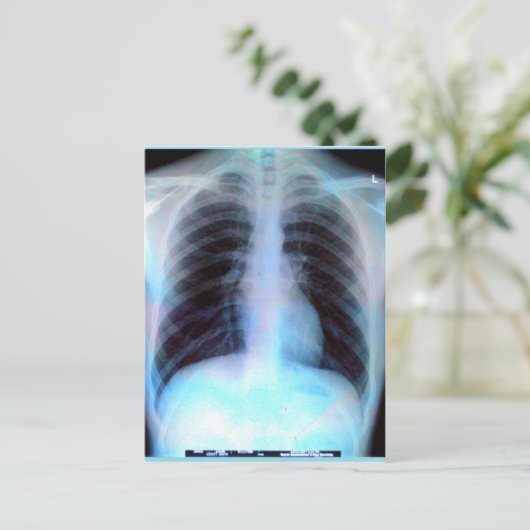 Ribcage Xray Skeleton Postkarte (Stehend Vorderseite)