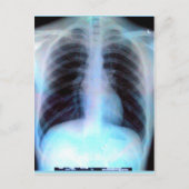 Ribcage Xray Skeleton Postkarte (Vorderseite)