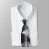 Röntgen 2 krawatte (Gebunden)