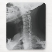 Röntgen 2 mousepad (Vorne)