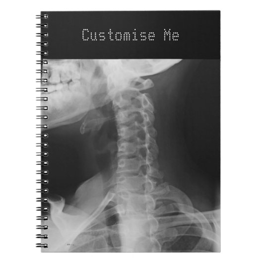 Röntgen 2 notizblock (Vorderseite)