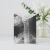 Röntgen 2 postkarte (Stehend Vorderseite)