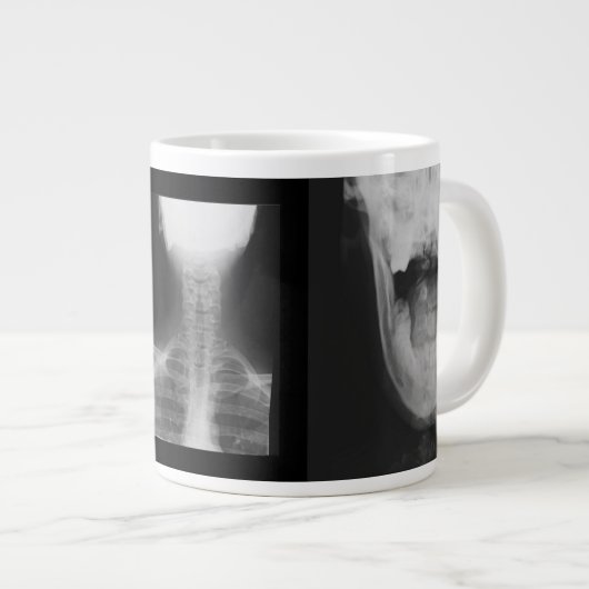 Röntgen 3 Jumbo-Tasse (Vorderseite Rechts)