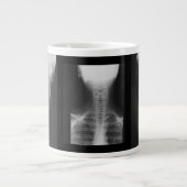 Röntgen 3 Jumbo-Tasse (Vorderseite)