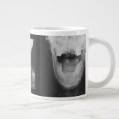 Röntgen 3 Jumbo-Tasse (Rechts)