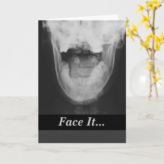 Röntgen 3 karte (Gelbe Blume)