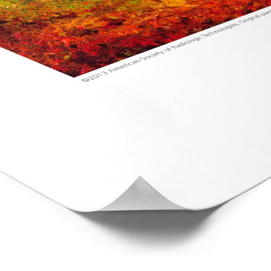 Röntgen-Deckkunst - Alte Eichenkiste CT von L. Rai Poster (Ecke)