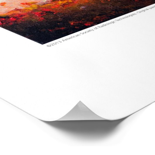 Röntgen-Deckkunst - Stormy Cerebral von L. Rainey Poster (Ecke)