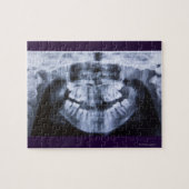 Röntgen eines Mädchenjungen mit Panoramablick Puzzle (Horizontal)