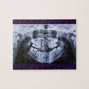 Röntgen eines Mädchenjungen mit Panoramablick Puzzle