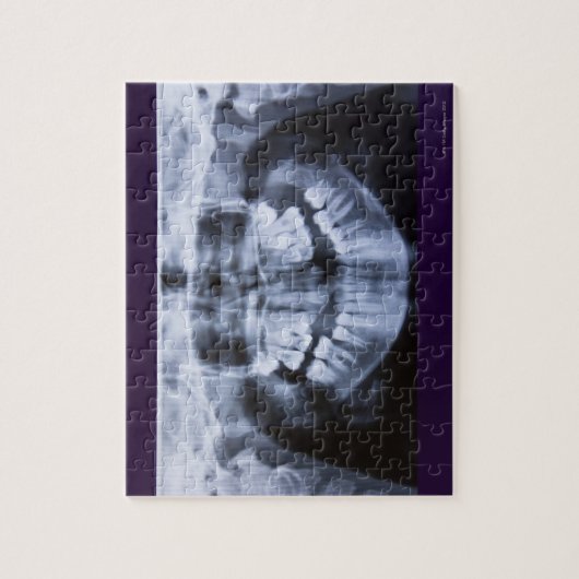 Röntgen eines Mädchenjungen mit Panoramablick Puzzle (Vertikal)