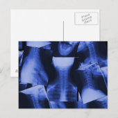 röntgen - elektromagnetisches Blau Postkarte (Vorne/Hinten)