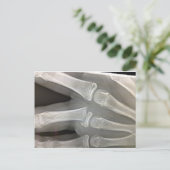 Röntgen-Knochenbrüche werden bald gesund Postkarte (Stehend Vorderseite)