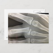 Röntgen-Knochenbrüche werden bald gesund Postkarte (Vorne/Hinten)