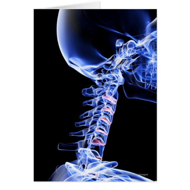 Röntgen Sie Bild der Knochen des Halses (Vorne)