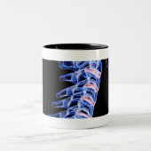 Röntgen Sie Bild der Knochen des Halses Zweifarbige Tasse (Mittel)