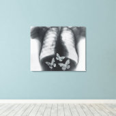 Röntgen von Schmetterlingen im Magen Leinwanddruck (Insitu (Holzboden))