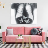 Röntgen von Schmetterlingen im Magen Leinwanddruck (Insitu (Wohnzimmer))