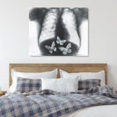 Röntgen von Schmetterlingen im Magen Leinwanddruck (Insitu (Schlafzimmer))