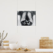 Röntgen von Schmetterlingen im Magen Poster (Küche)