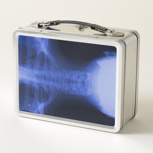 Röntgenaufnahme 2 - elektromagnetisches Blau Metall Brotdose (Rückseite)