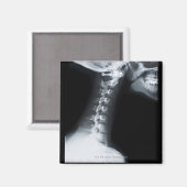 Röntgenaufnahme der Halswirbel einschließlich Unte Magnet (Vorderseite/Rückseite)