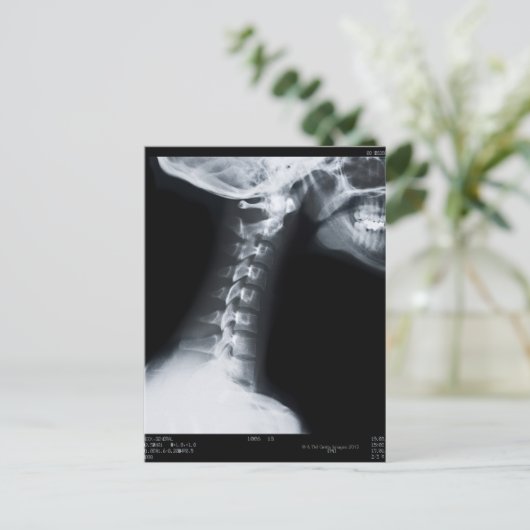 Röntgenaufnahme der Halswirbel einschließlich Unte Postkarte (Stehend Vorderseite)